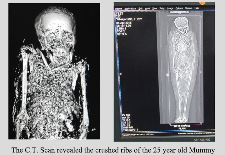 Picture 4 of New discovery about 2300-year-old Egyptian mummy