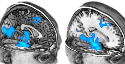 Picture 2 of New discovery of the 'horrifying hallucination' of ecstasy