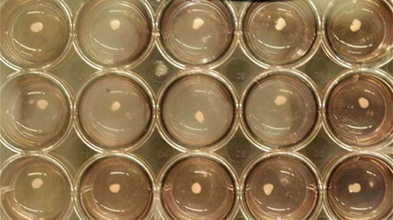 Picture 1 of New hope for patients with liver failure