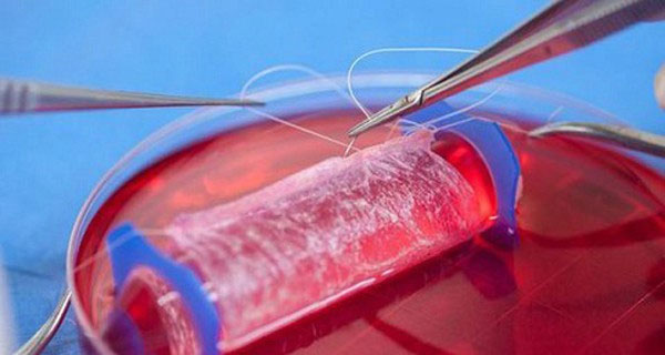 Picture 3 of New hope for penile regeneration in humans