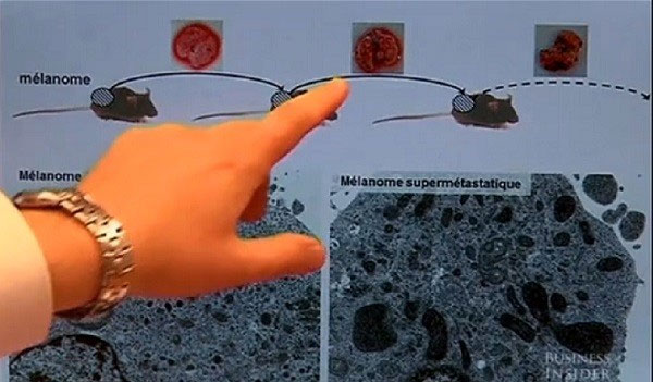 Picture 6 of New ideas can eliminate cancer cell's metastasis
