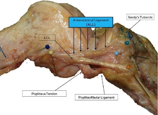 Picture 1 of New parts discovered in the human knee