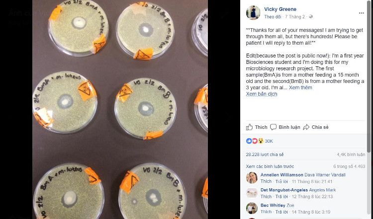 Picture 2 of New research: Breast milk is capable of killing all types of bacteria