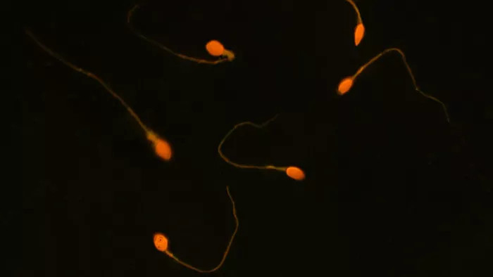 Picture 1 of New research on contraceptives for both men and women cures infertility in men