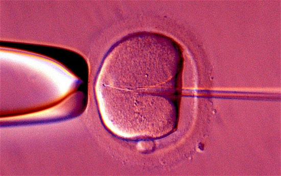 Picture 1 of New techniques help increase the effectiveness of artificial insemination