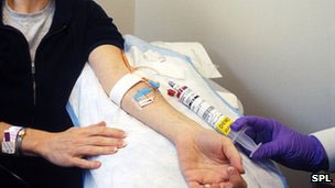 Picture 1 of New treatment for liver cancer patients
