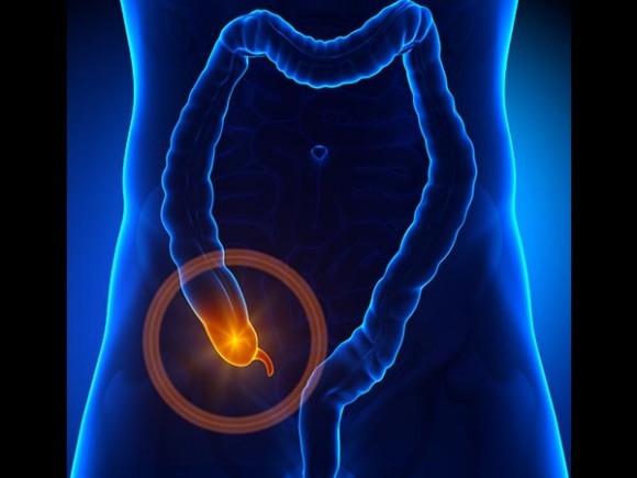 Picture 2 of No body parts are okay