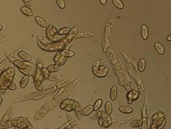 Picture 1 of No sexual reproduction but still gene exchange
