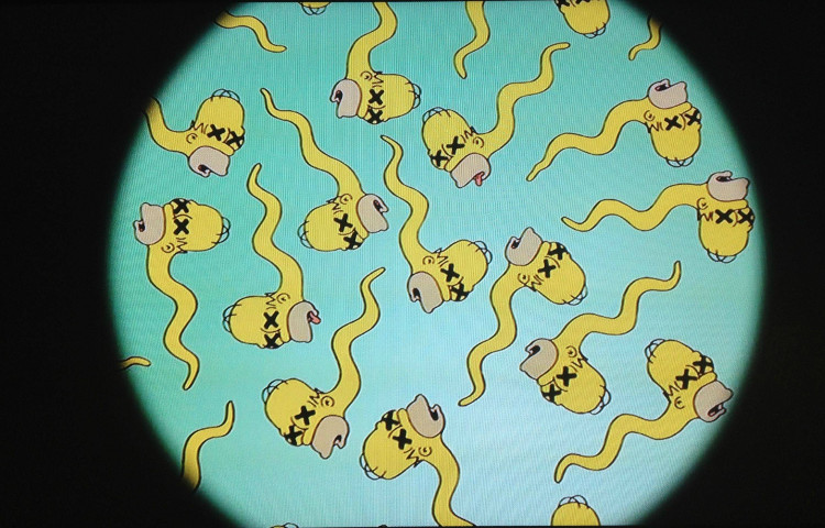 Picture 3 of Normal indicators when evaluating a semen test