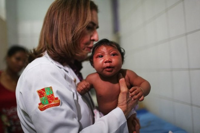 Picture 1 of Not Zika but Monsanto's chemicals cause brain atrophy?