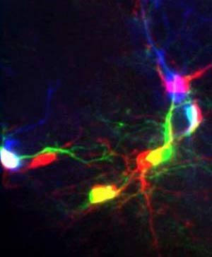 Picture 1 of Observe the development of brain cells according to the real-time system