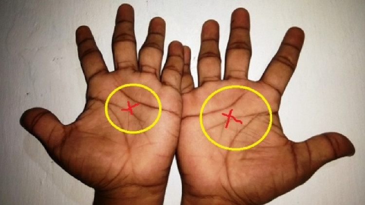 Picture 1 of Only 3% of people in the world own this finger line, what is it special?