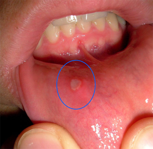 Picture 2 of Oral health shows your health