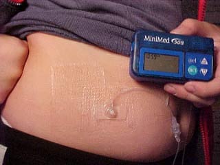 Oral insulin test to prevent type 1 diabetes images 1