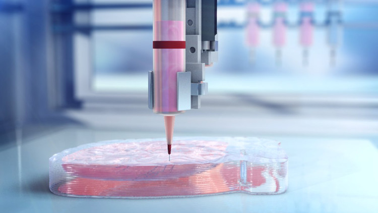 Picture 1 of Organ transplantation ... 3D printing
