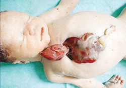 Picture 2 of Organ transplants between species