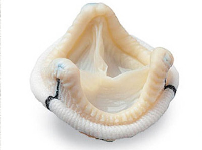 Picture 2 of Other artificial heart valves are how to have a heart valve