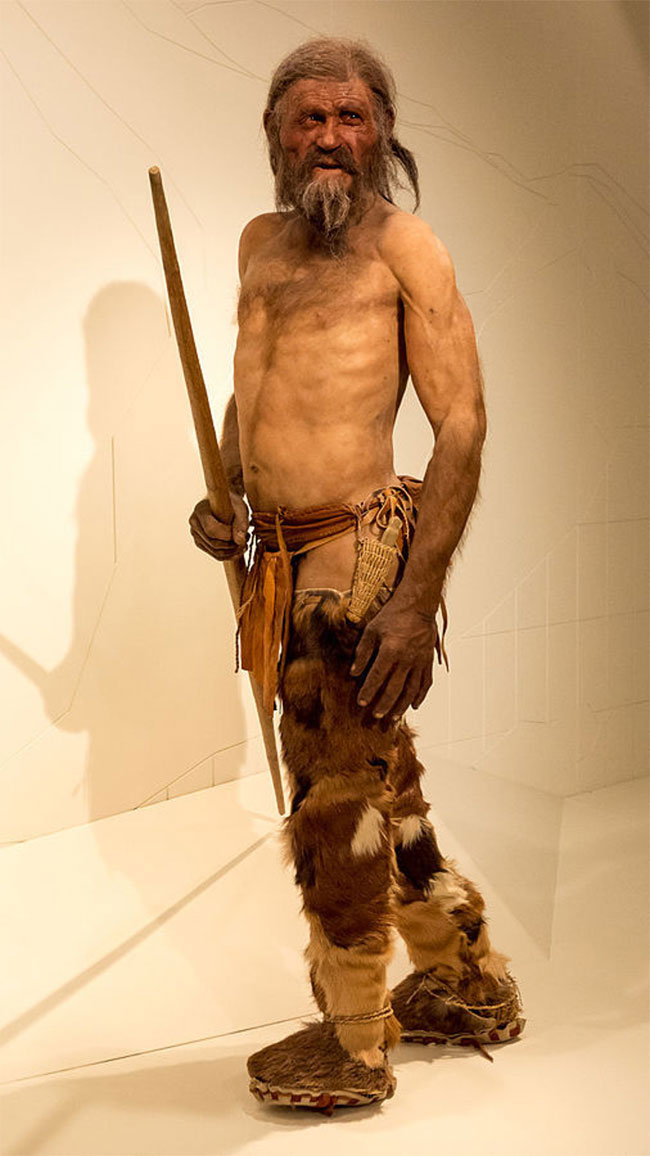 Picture 1 of Otzi tapes and new findings are useful for medicine