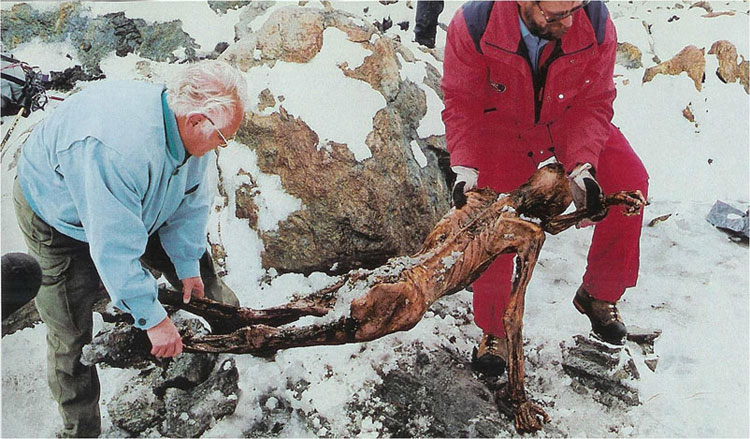Picture 2 of Otzi tapes and new findings are useful for medicine