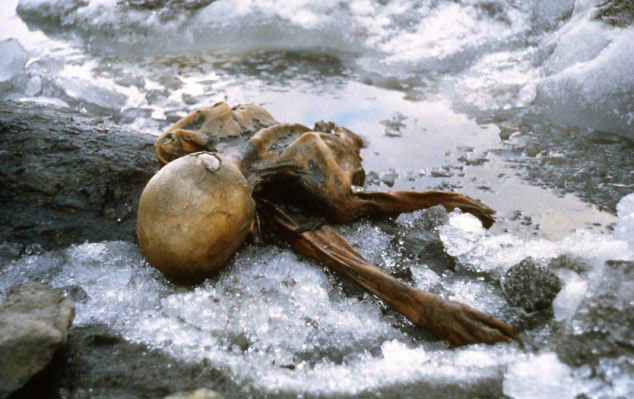 Picture 3 of Otzi tapes and new findings are useful for medicine