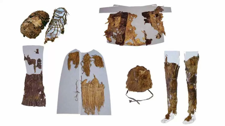 Picture 4 of Otzi tapes and new findings are useful for medicine