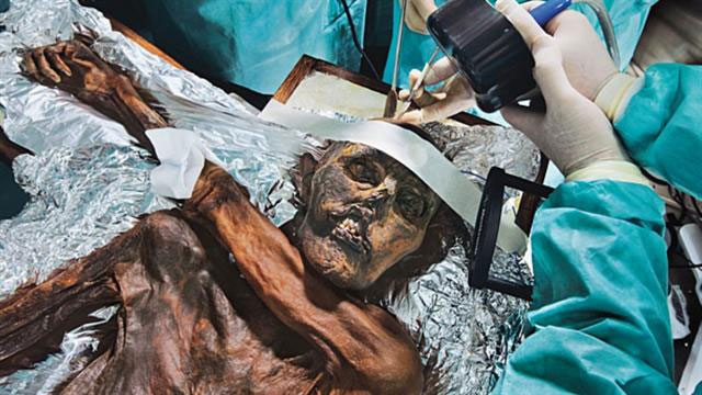 Picture 5 of Otzi tapes and new findings are useful for medicine
