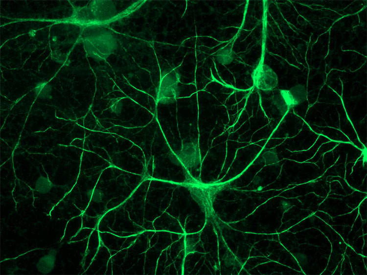 Picture 2 of Our brains tend to predict the future, do you realize that?