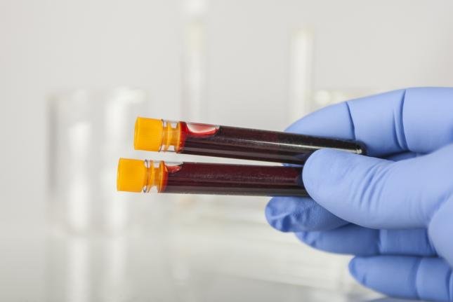Picture 5 of Outstanding scientific findings in 2015