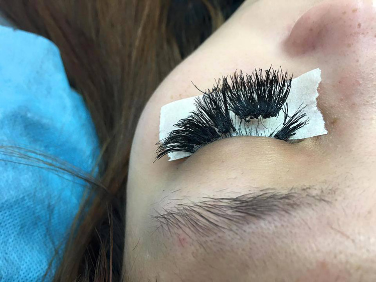 Picture 2 of Owning this 'eyelash line', you are one of the special people in the world