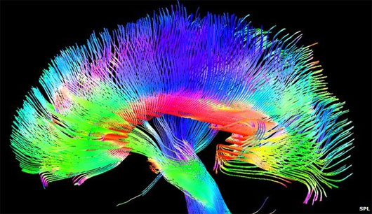 Picture 1 of Painters have a different brain structure than ordinary people