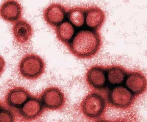 Picture 3 of Pandemic & infectious diseases in human history