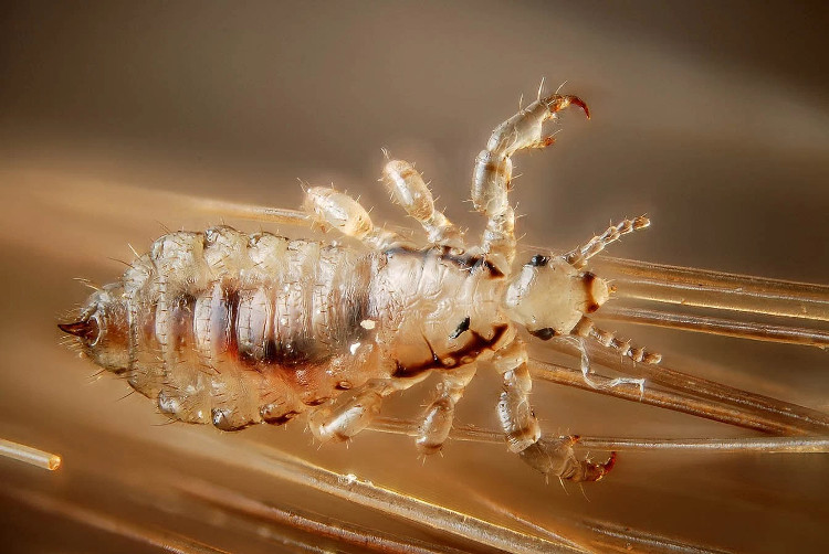 Picture 2 of Pandemic hair is about to explode when 98% of lice are resistant