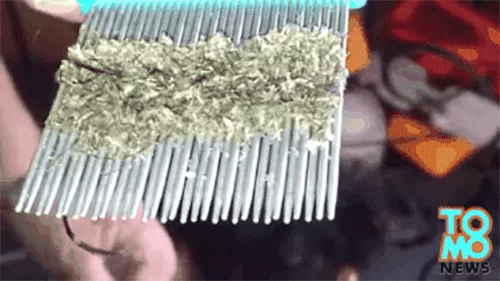 Picture 3 of Pandemic hair is about to explode when 98% of lice are resistant