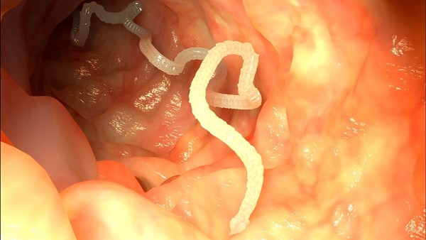 Picture 3 of Parasites like to nest and eat human brains