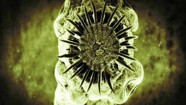 Picture 4 of Parasites like to nest and eat human brains