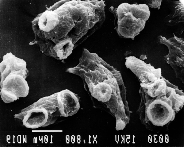 Picture 6 of Parasites like to nest and eat human brains