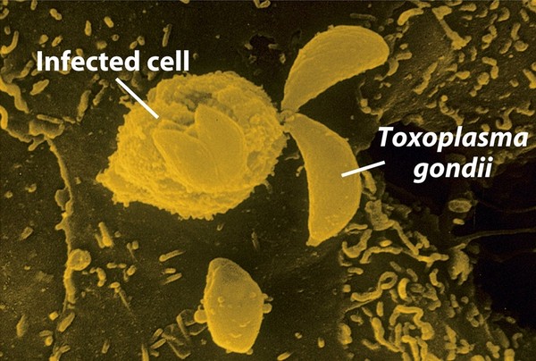 Picture 9 of Parasites like to nest and eat human brains