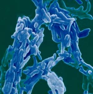 Picture 1 of Passive smoking is at risk for tuberculosis in children