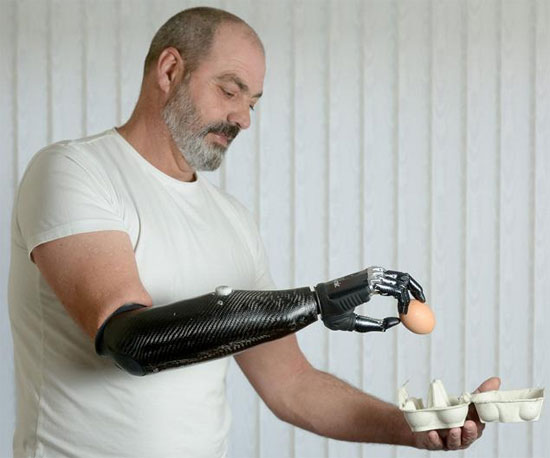 Picture 1 of People can regenerate lost legs and arms
