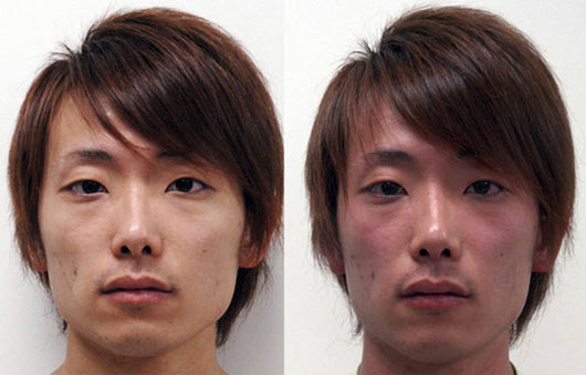 Picture 2 of People who drink alcohol are blushed so be careful