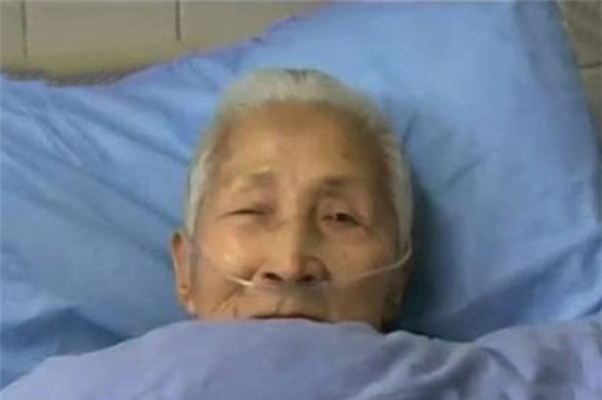 Picture 3 of People who 'molt' after a stroke