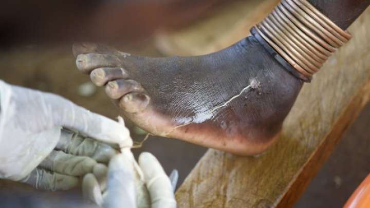 Picture 2 of People will permanently erase the dreaded disease on a global scale