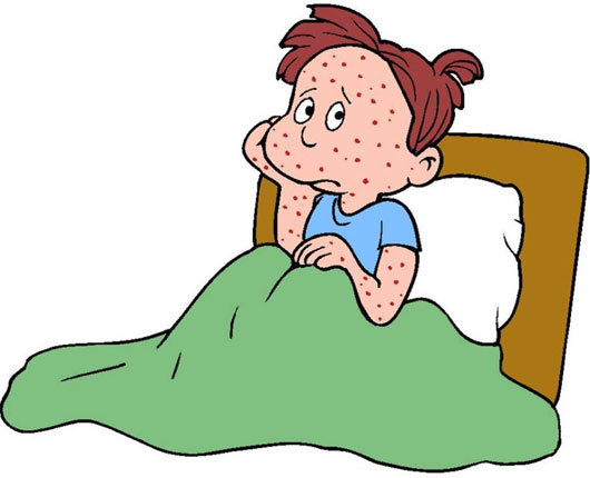 Picture 1 of People with chickenpox in Hanoi suddenly increased