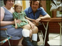 Picture 1 of People with legs weighing 70 kg