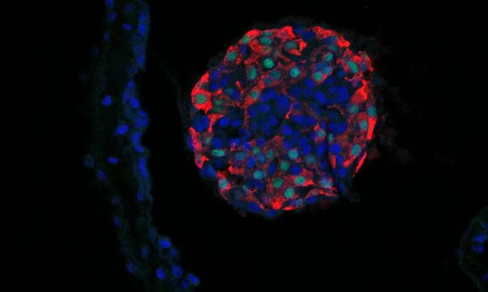 Picture 2 of People with type 1 diabetes may give up insulin injections because of this study