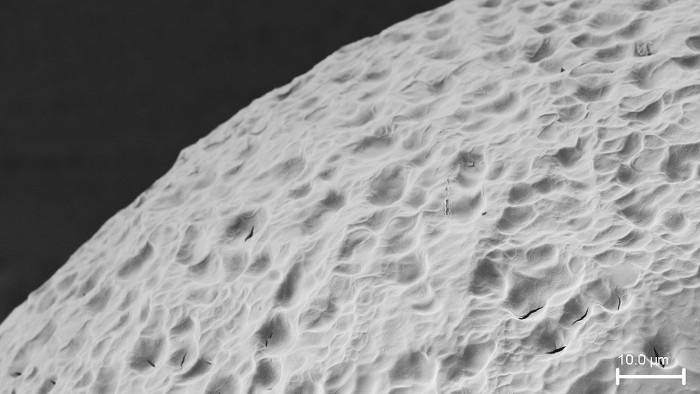 Picture 3 of People with type 1 diabetes may give up insulin injections because of this study