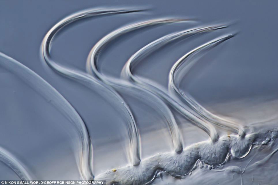 Picture 12 of Photos taken through the most beautiful microscope in 2012