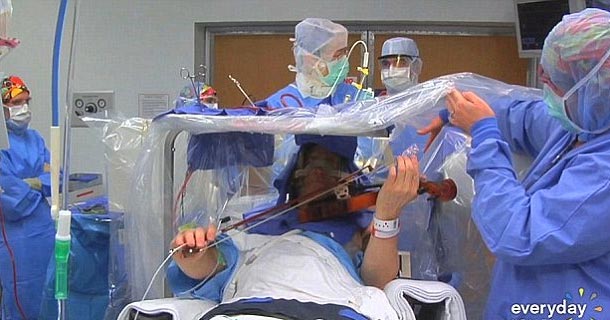 Picture 2 of Play the piano and sing while being brain surgery