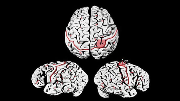 Picture 3 of Power affects the brain and voice