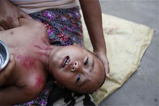 Picture 1 of Predicting malaria epidemic thanks to sea temperature